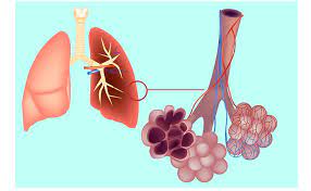 Enfisema Polmonare Sintomi Cause Cura Serendipity