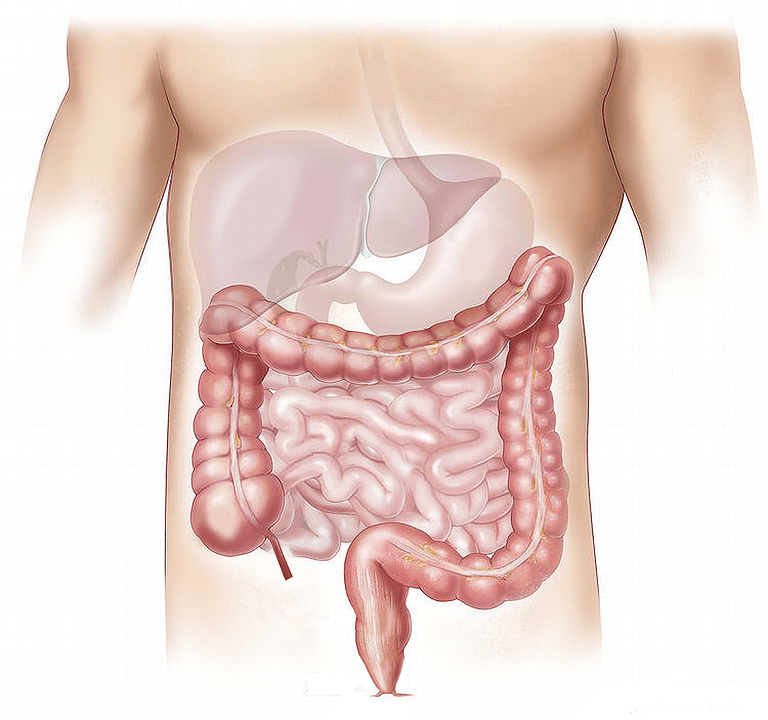 Scopri di più sull'articolo Cancro al colon