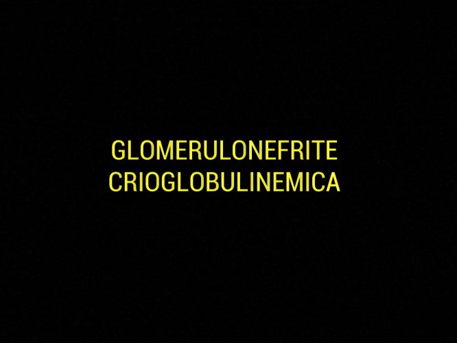 Glomerulonefrite crioglobulinemica