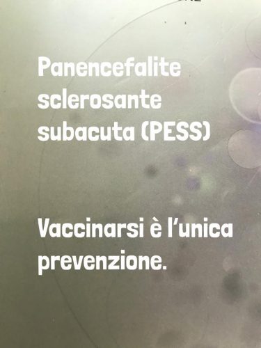 La panencefalite sclerosante subacuta è associata alla persistenza nel sistema nervoso centrale di un virus del morbillo difettivo