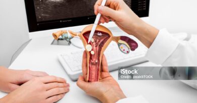 I polipi uterini sono delle escrescenze benigne (non cancerose) che si sviluppano sulla mucosa interna dell'utero, l'endometrio.