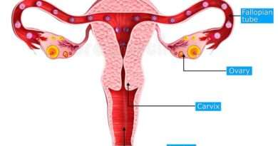 Le ovaie sono due organi ghiandolari, di forma ovale, grandi come una prugna, situate nella pelvi femminile, ai lati dell'utero.