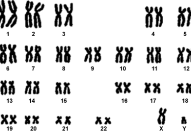 Le anomalie cromosomiche fetali sono alterazioni del numero o della struttura dei cromosomi del feto. I cromosomi sono strutture filiformi presenti nel nucleo delle cellule, che contengono il materiale genetico. Ogni persona ha 46 cromosomi, divisi in 23 coppie.